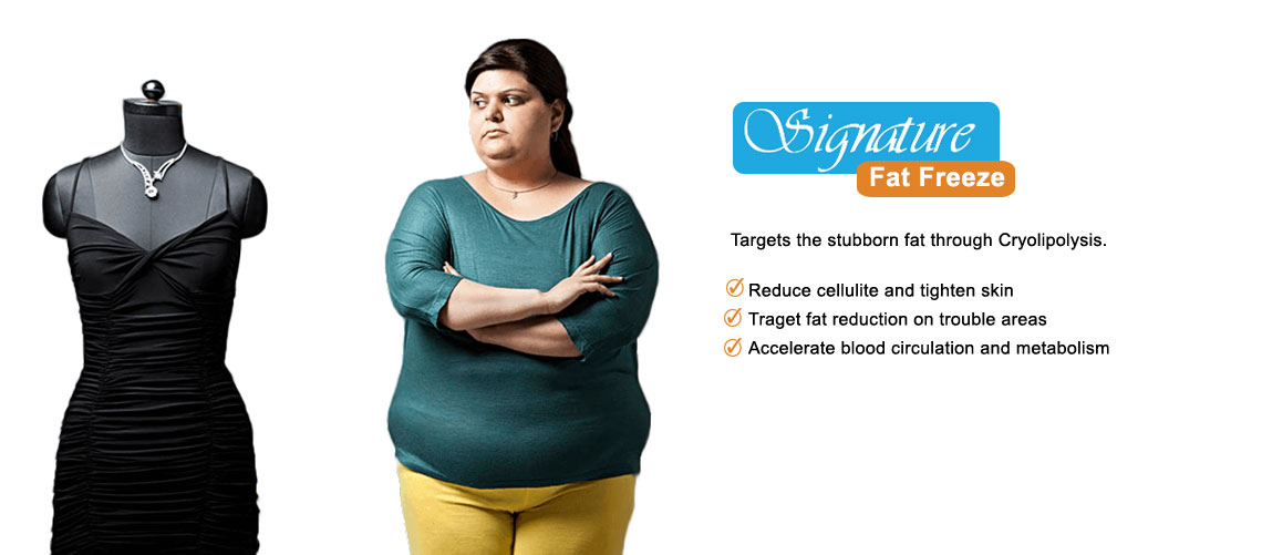 Signature Fat Freeze